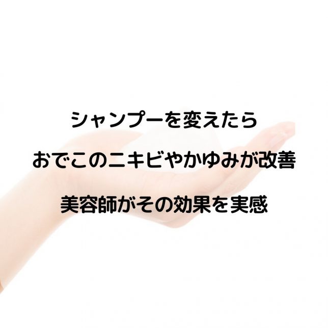 シャンプーを変えたらおでこのニキビやかゆみが改善 美容師が効果を実感